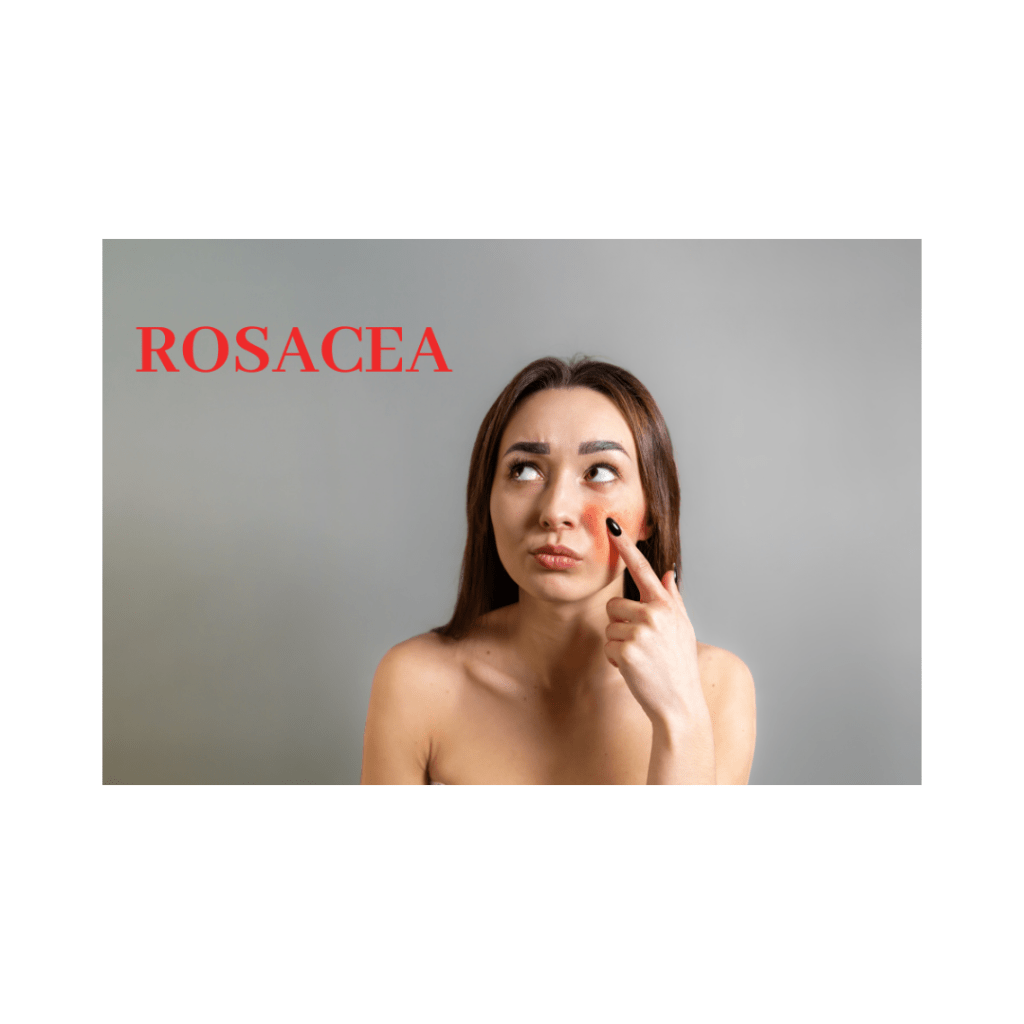 Rosacea is a leading skin condition that frustrates millions each year. As shared by @thechristinereport and @mettalusso